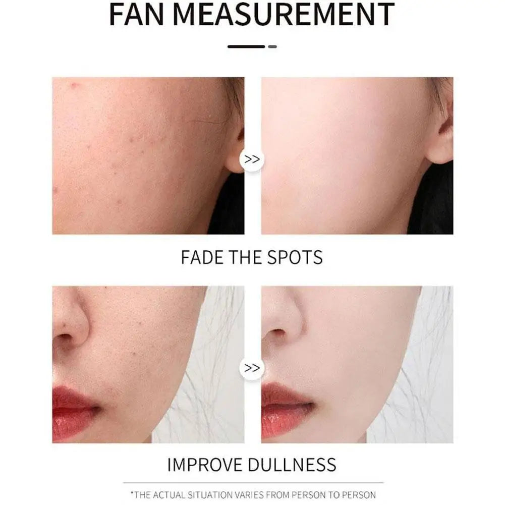 Vichy Liftactiv Supreme H.A. Serum – Wrinkle Corrector